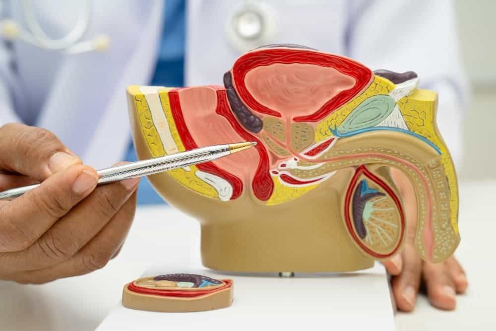 Varicocele Embolisation