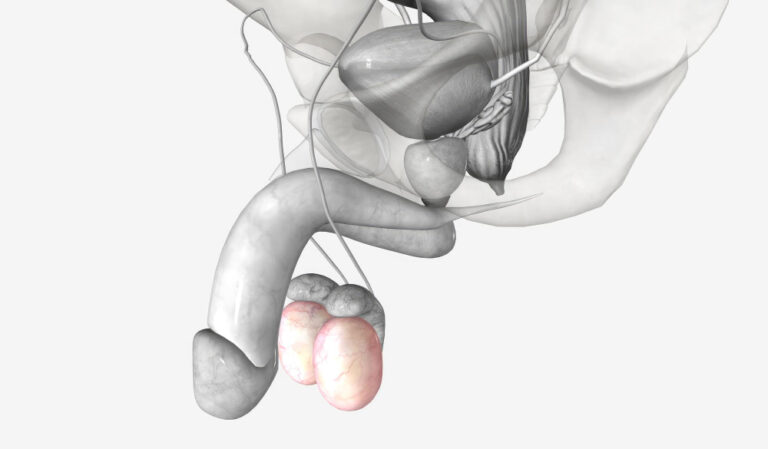 كيس الصفن: الشكل الطبيعي، الالتهابات، والاضطرابات المحتملة