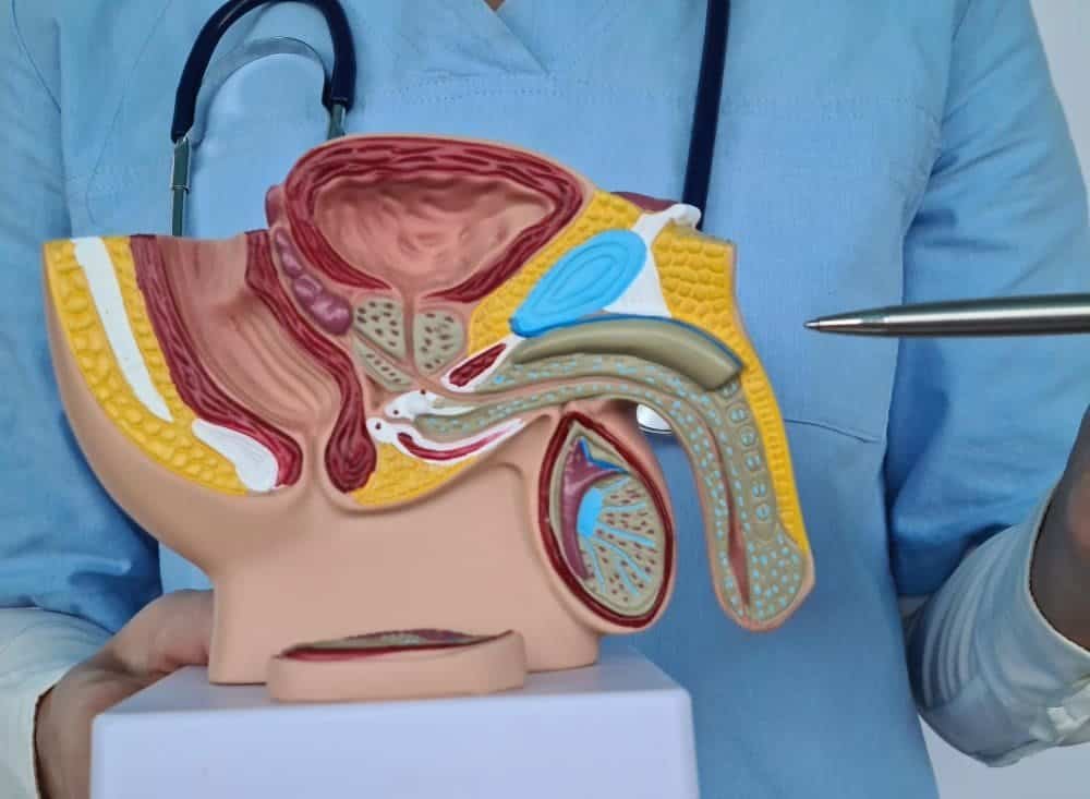 Varicocele Embolisation