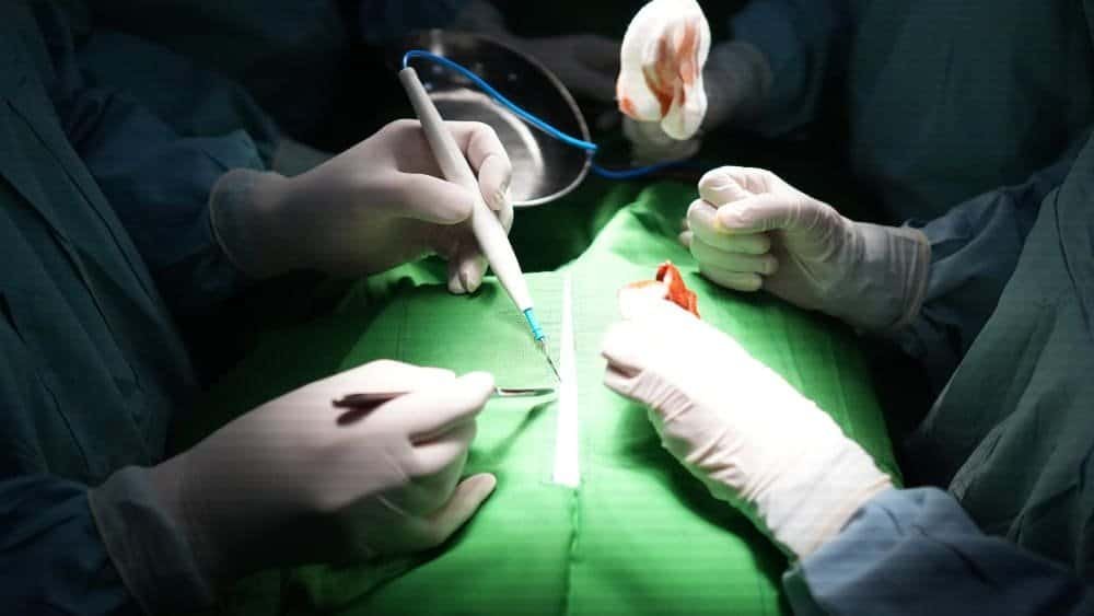 Long-Term Side Effects of Varicocele Surgery