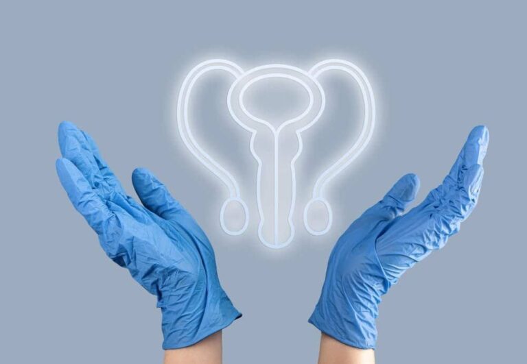 دوالي الخصية درجة ثانية: هل تحتاج عملية؟ 