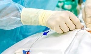 ما أسباب عودة دوالي الخصية بعد العملية؟